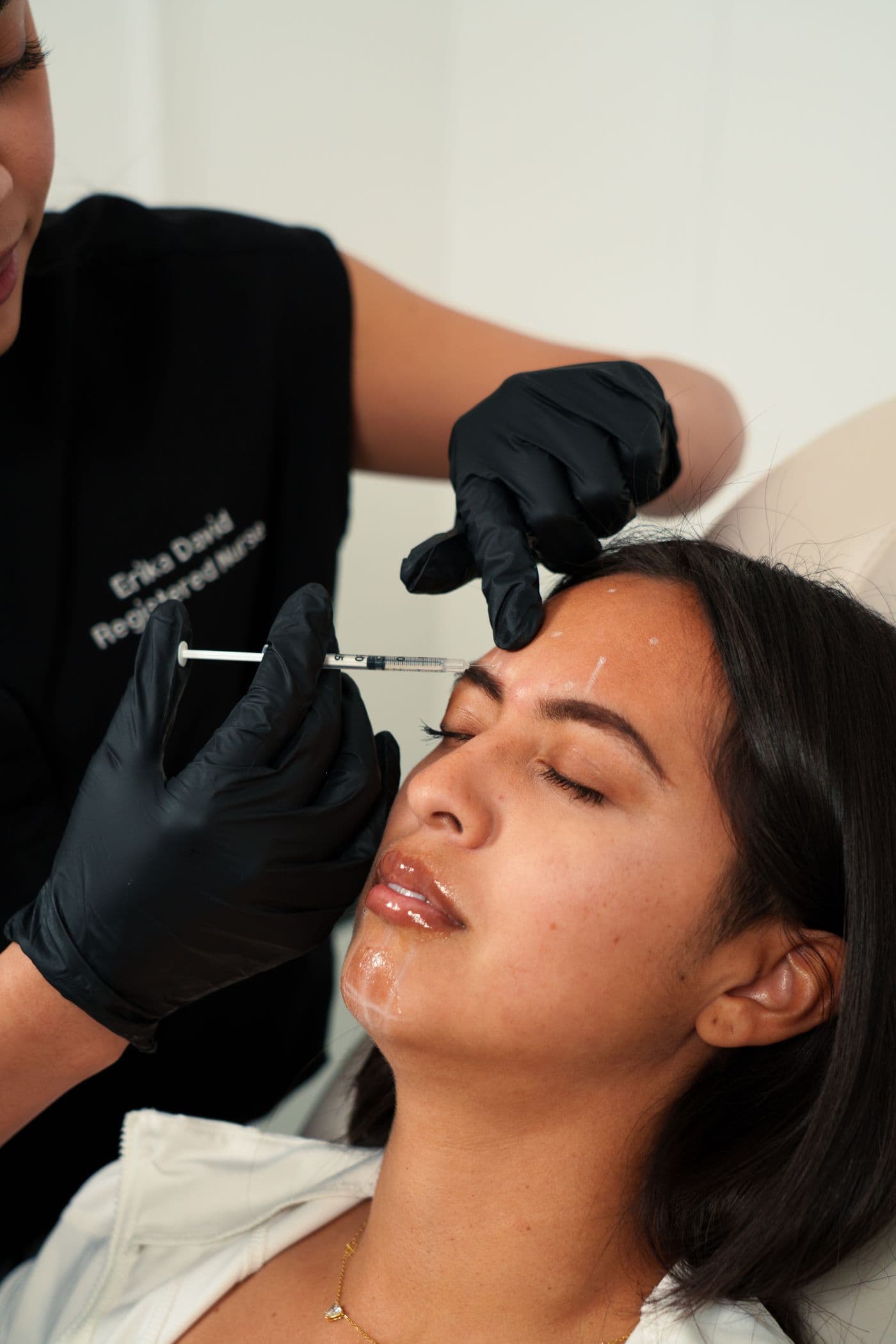 Nurse injector administering a neuromodulator to a patient's forehead in a med spa