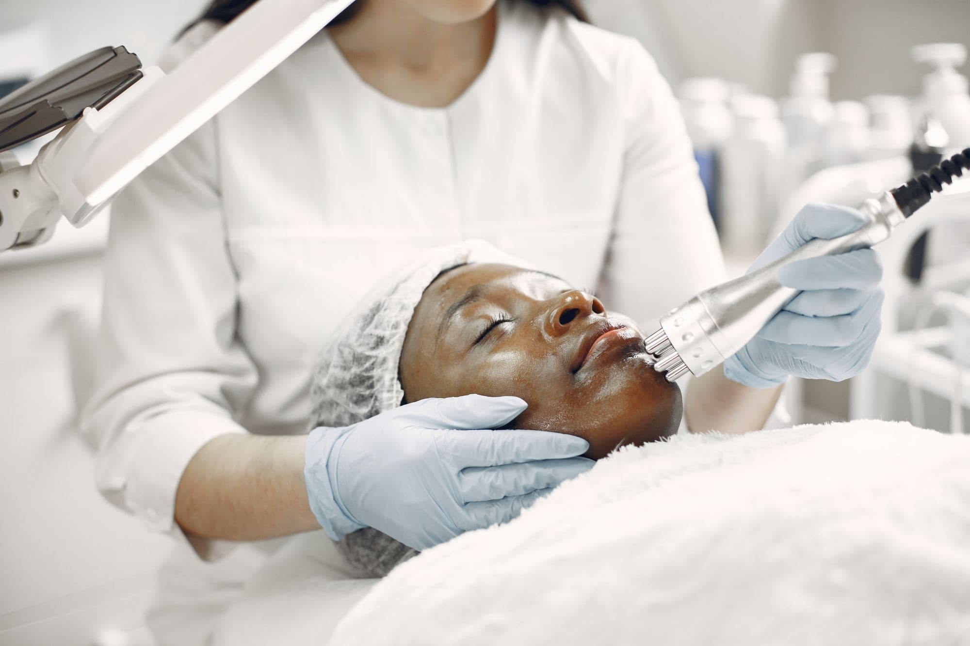 Gloved hand holding the cryo-cooled laser handpiece against a patient's cheek