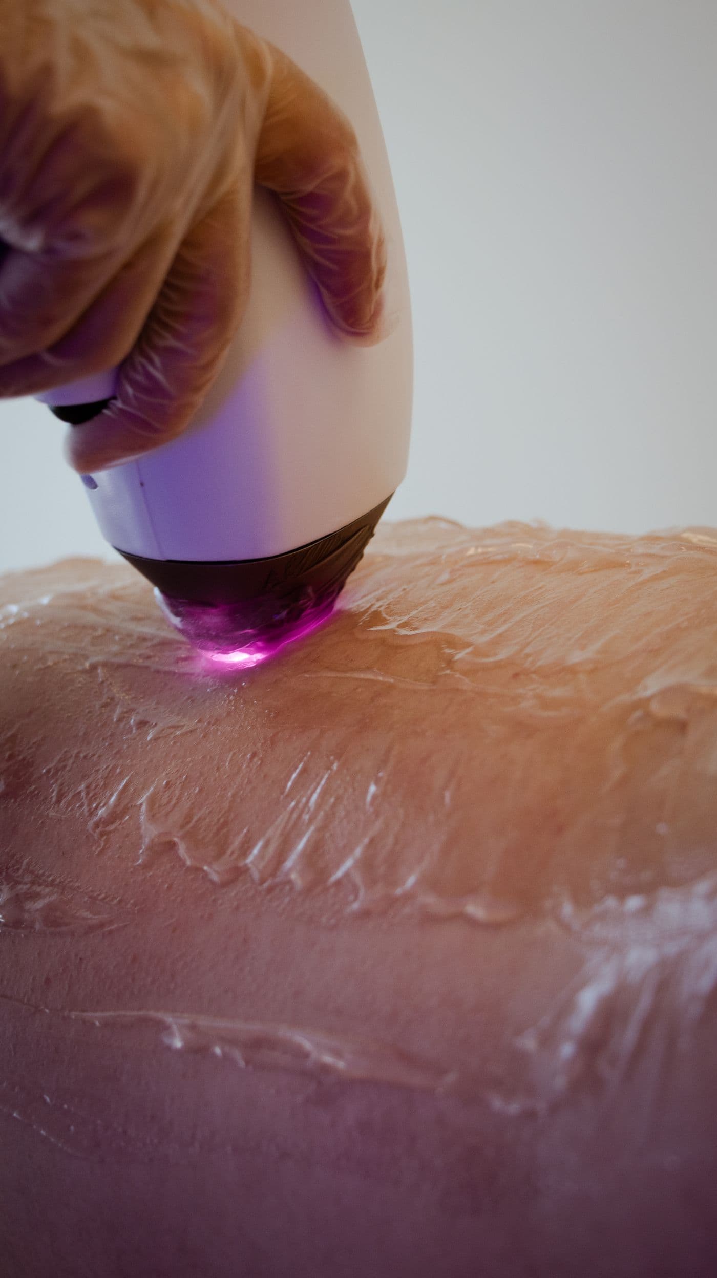 Close-up of a laser handpiece tip on skin