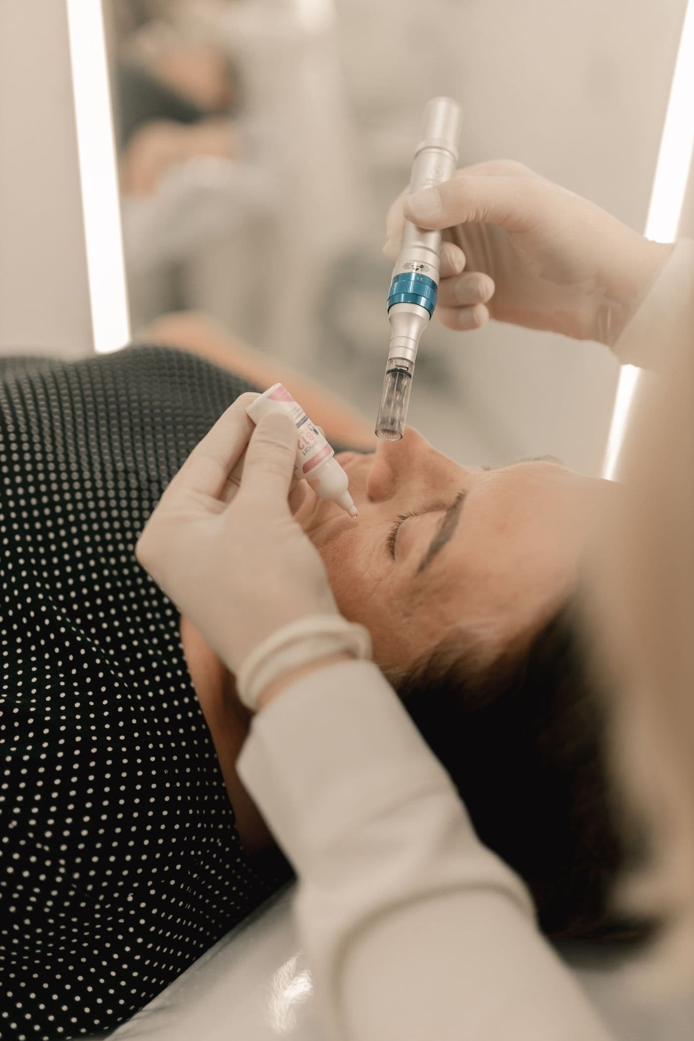 Close-up of a microneedling pen gliding across a patient's cheek